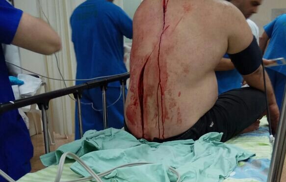 אחד מפצועי הדקירה